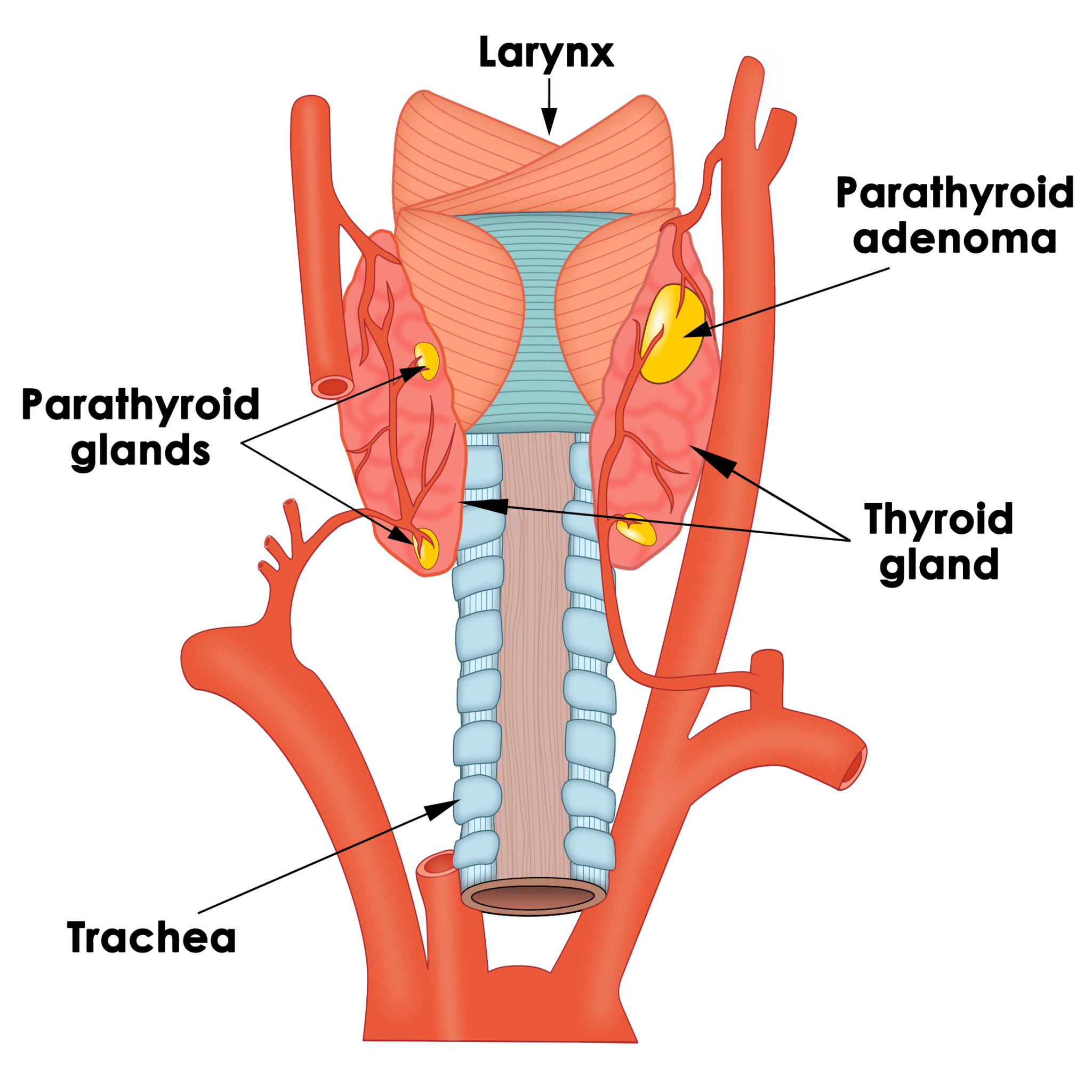 Parathyroid Conditions Information Dr Ben Lancashire