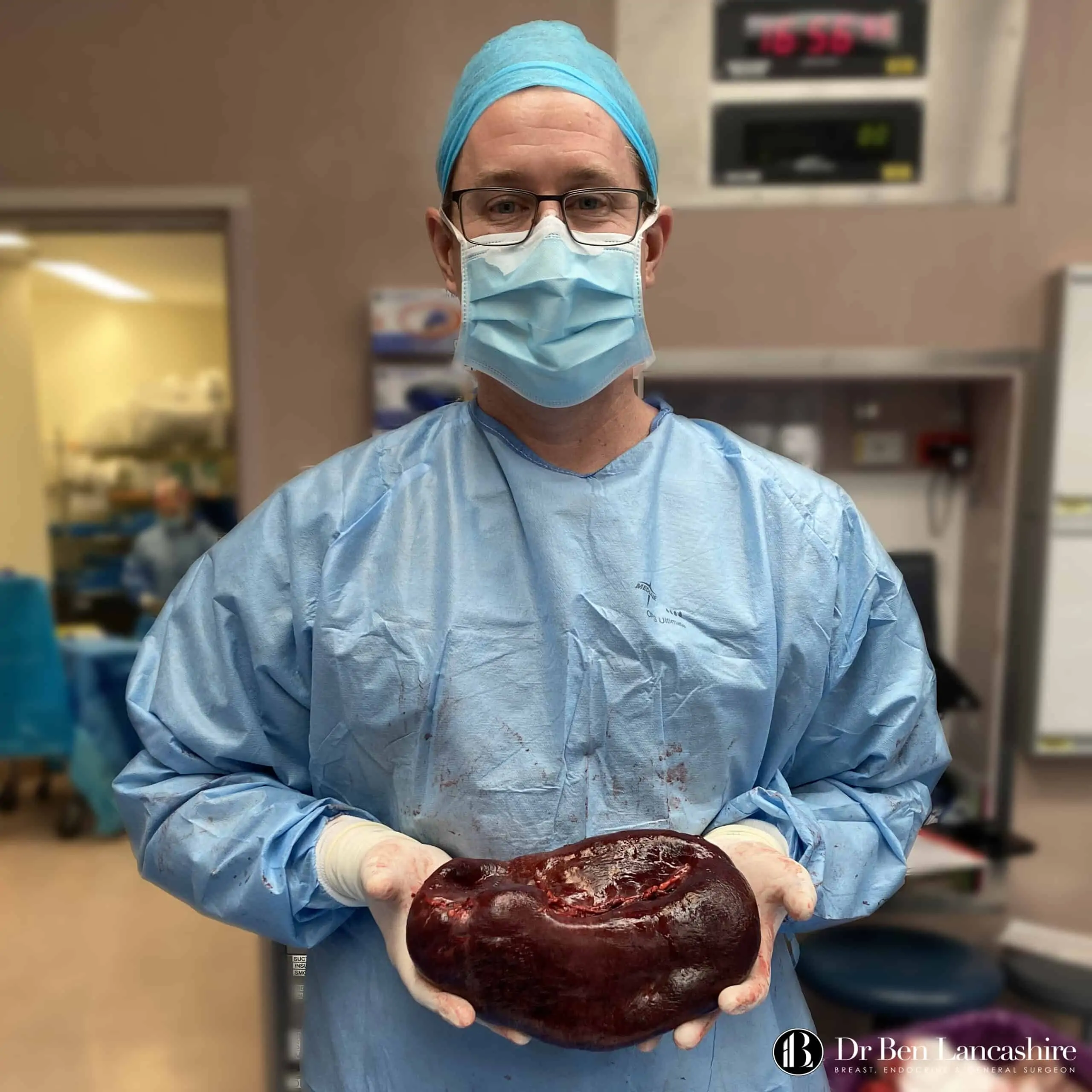 general surgeon carrying a spleen
