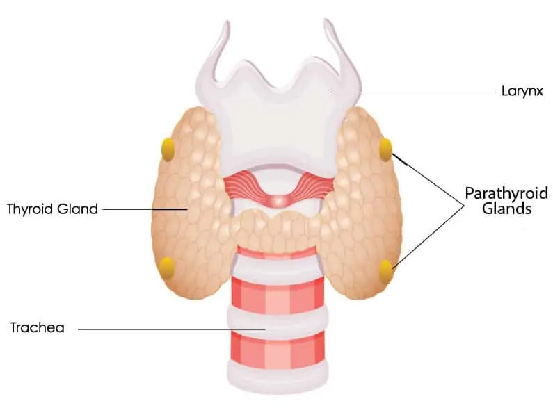 Hyperparathyroidism infographic showing the thyroid and parathyroid glands